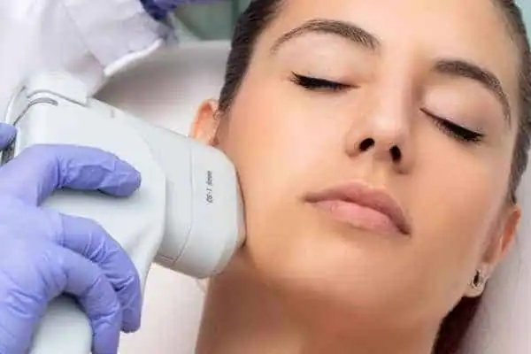 Image of woman having HIFU Lutterworth treatment