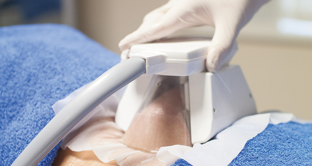 How Fat Freezing and HIFU Work Together? 2 Multiple Areas in One Session HIFU and Fat Freezing Lutterworth