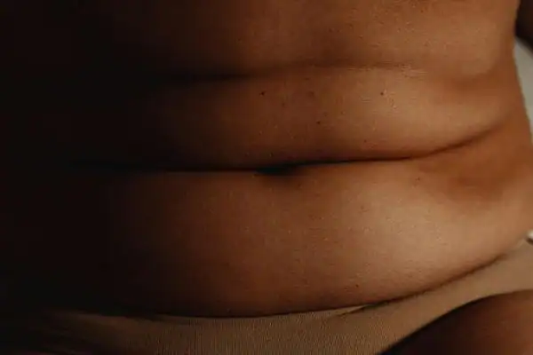 The Hidden Connection: How Stress Shapes Your Fitness and Body Composition 3 image of what stress can do on the stomach area and how Lipo 360 Lutterworth can help to change your body shape.